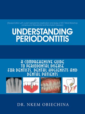 cover image of Understanding Periodontitis